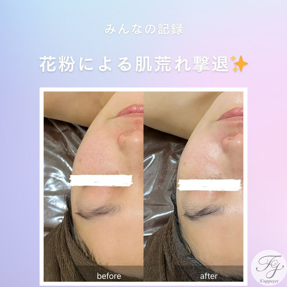 ブログ