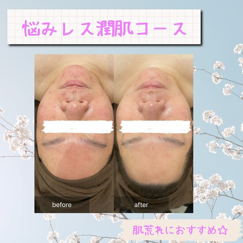 ブログ